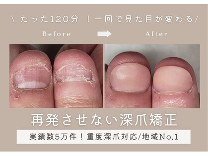 ティアラネイル 宇都宮の写真