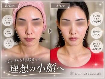 タロ(talo)の写真/むくみ/たるみ/二重あご/エラ張り/左右差/面長などのお悩み解消!独自技術の小顔矯正!美骨巡整♪