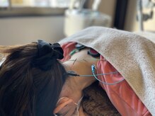 はりきゅう院 さくら/肩こりや頭痛に