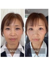 ハッピービューティーサロン じゆう(Happy Beauty Salon J∞YOU)/人気No.1/魔法の小顔矯正/3回目
