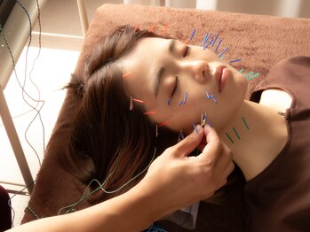 深谷接骨院/小顔美容鍼（電気パルス）