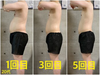 ペリー(PELLY)/男性20代 before after