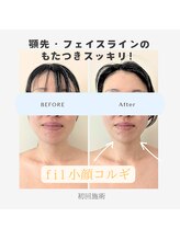 フィル 名駅店(fil)/【リピートNo.1】fil 小顔コルギ