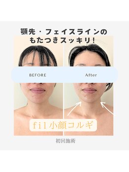 フィル 名駅店(fil)/【リピートNo.1】fil 小顔コルギ