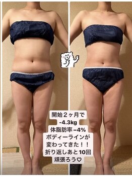 ヨサパーク ハット(YOSA PARK HAT)/劇的ダイエット