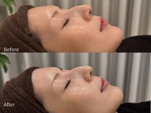 アウラ 小杉店(AULA)/