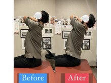 ナオル整体 宮崎院(NAORU整体)/30代男性施術事例【猫背改善】