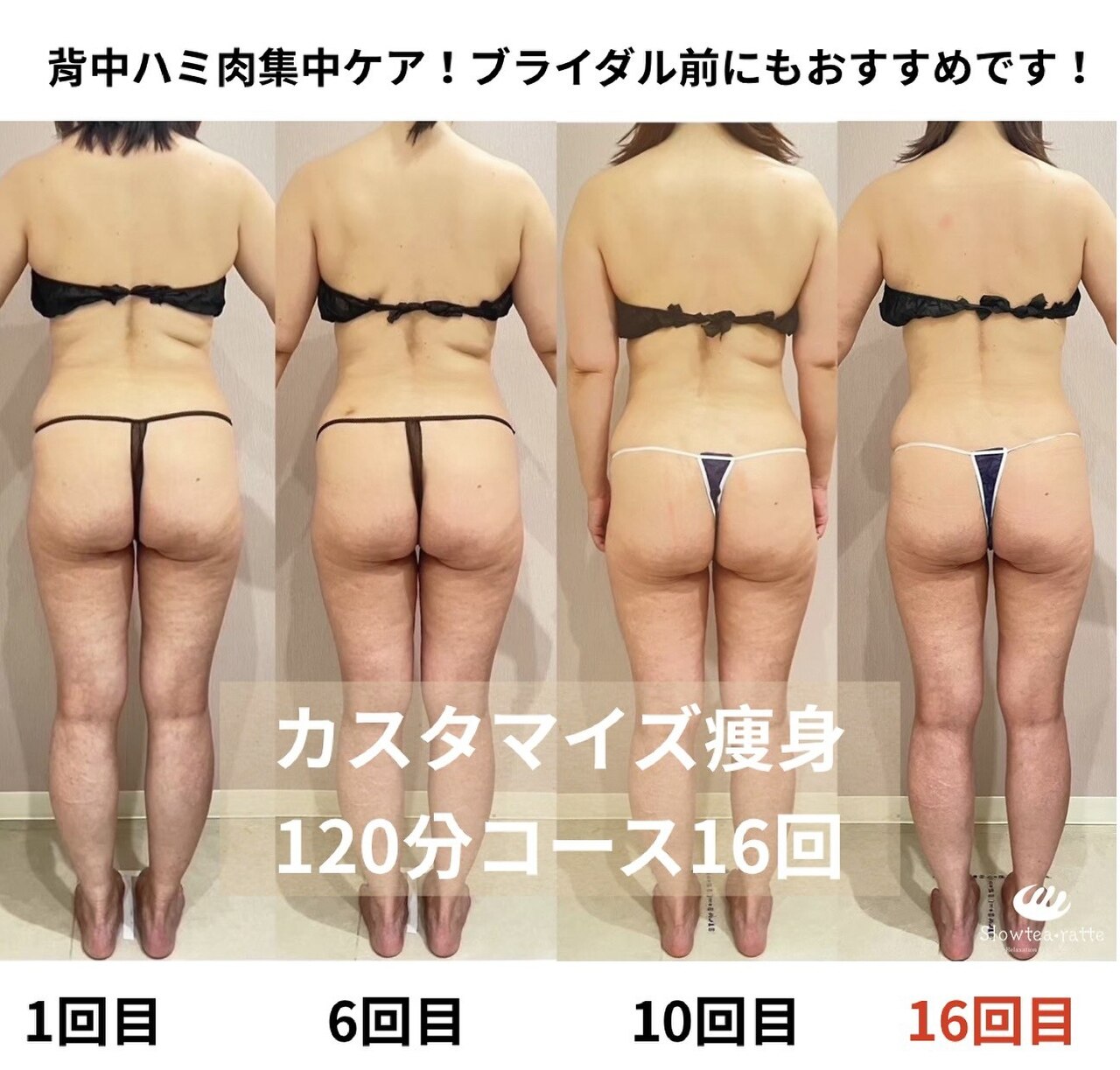 ブライダルメニューがあるサロン！栄・錦で人気のエステ,脱毛,痩身