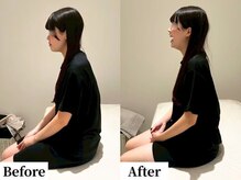 ソレア(Solea)/姿勢改善1回目 Before/After