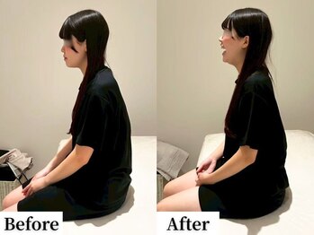 ソレア(Solea)/姿勢改善1回目 Before/After