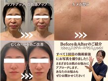 モリタ鍼灸整骨院