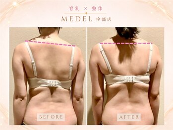 メデル(MEDEL)/左右差も整えてバストアップ