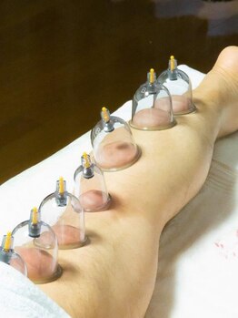 健美癒 ラ サンテ/カッピング【4】