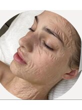 ブルームーン(Blue Moon)/シワ改善に♪ゾンビパック