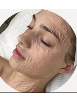 ブルームーン(Blue Moon)/シワ改善に♪ゾンビパック