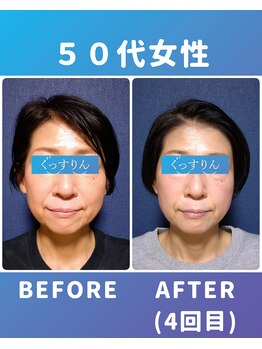 ぐっすりん/複数回継続のお客様の変化(7)