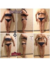 アンリール 苫小牧店(ANRIRE)/ボディー施術のお客様です