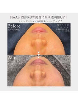 ビースタジオブランジュ(B STUDIO blange)/HAAB REPRO◇ハーブピーリング