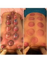 ラクラク健康堂 桜木町店(RAKURAKU健康堂)/見た目は怖いけど効果は抜群！