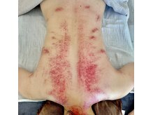 ビレイ(Birei)/カッサ