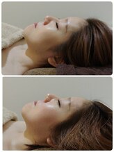 吉川美南ライフ整骨院/30代女性