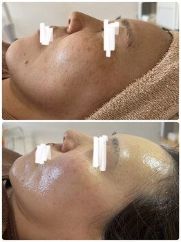 サロンニーナ(Salon.Nina)/韓国肌管理セルマン