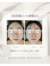 イチカ 仙川店( ichika)/食いしばりを原因から緩める