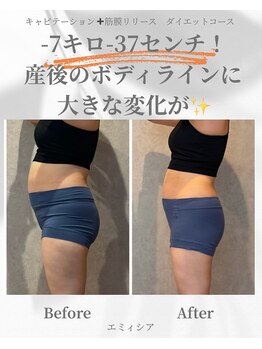 エミィシア(Emisia)/