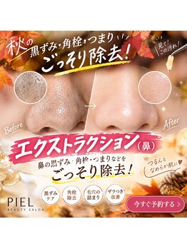 ピエル 柏店(PIEL)の写真/【柏の毛穴迷子が最後に辿り着く】頑固な黒ずみ・詰まりを根本洗浄!男女問わず絶賛の毛穴肌質改善サロン