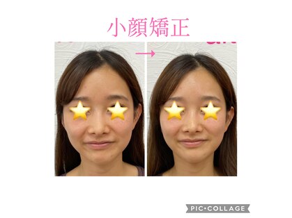 カレン(Current)の写真