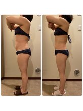 エステティック レイビス 青森店(RAYVIS)/ダイエットモニター募集中！