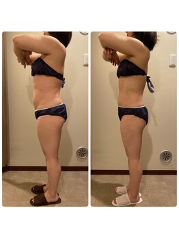 エステティック レイビス 青森店(RAYVIS)/ダイエットモニター募集中!