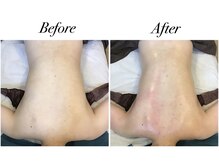 エステティックサロン フェアリー(ESTHETIC SALON FAIRLY)/痩身ブライダル　Before→After