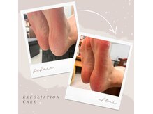 モハラ(Mohala)/かかと角質ケア