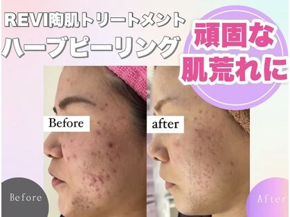 ホワイトアクア 川崎店(WHITE AQUA)の写真