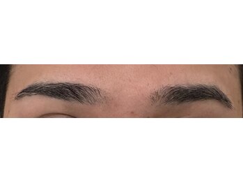 アレッド 大阪店(ared.)/眉毛脱毛