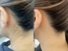 アイズ ビューティケア(eyes. beauty care)/まとめ髪が映える♪♪うなじWAX