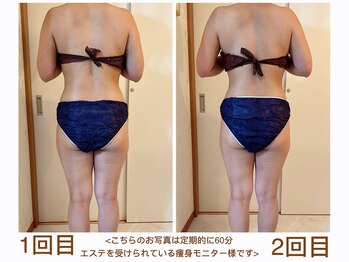 ルル リラクゼーション(RURU Relaxation)/ダイエット/ボディライン