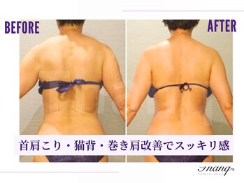 サンク(Thanq)/凝り太り・疲労太り・歪み太り