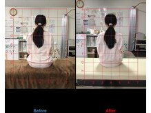 ストレチックス 近江八幡店/首・肩に痛みがあった女性