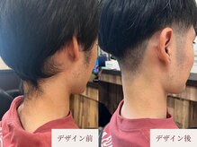 クラームビューティー(Clerm beauty)/美容師によるうなじデザイン脱毛