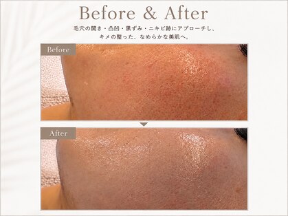 クラルテアンドコー(Salon Clarte&Co.)の写真