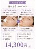 【ビビビ祭におすすめ】本気肌改善【再来】ハイアルチューン◇アクチュ－ン