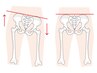 【骨盤矯正】 気になる体のゆがみに！まずは骨盤のゆがみから調整◎３０分