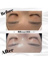 ワイドット(Y.)/艶肌WAX１回目