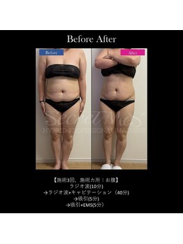 フェレザ 新潟(Felleza)/サイズダウンが目指せる◎