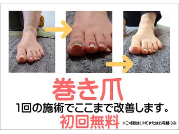 リラコン 那由多(RelaCon.)/巻き爪ケアもやってます。