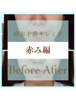 キレミラ 麻布十番店/赤み編