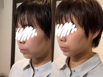 ハクト(Hakuto)/Before/After