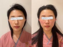 整体 王院長/バランスから整える小顔調整